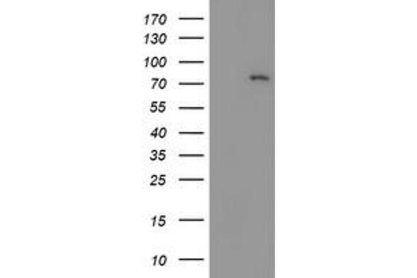 LIM Domain Kinase 1 抗体