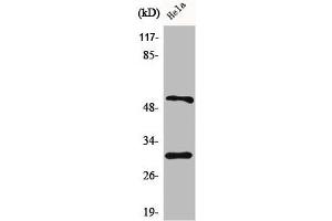 Western Blot analysis of HeLa cells using Caspase-10 B/C Polyclonal Antibody (Caspase 1 抗体  (C-Term))