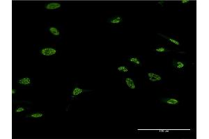 Immunofluorescence of monoclonal antibody to LHX4 on HeLa cell. (LHX4 抗体  (AA 291-390))