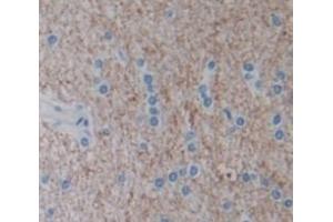 Used in DAB staining on fromalin fixed paraffin- embedded Kidney tissue (NOV 抗体  (AA 139-357))