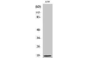 Western Blotting (WB) image for anti-Stathmin 1 (STMN1) (Ser732) antibody (ABIN3176674) (Stathmin 1 抗体  (Ser732))