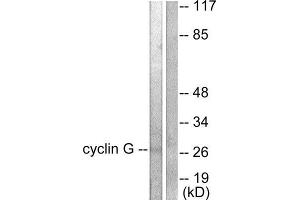 Western Blotting (WB) image for anti-Cyclin G1 (CCNG1) (Internal Region) antibody (ABIN1848500) (Cyclin G1 抗体  (Internal Region))