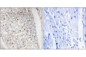 Immunohistochemistry analysis of paraffin-embedded human heart, using PKD1/2/3/PKC mu (Phospho-Ser738+Ser742) Antibody. (PKD1/2/3/PKC mu (AA 706-755), (pSer738) 抗体)