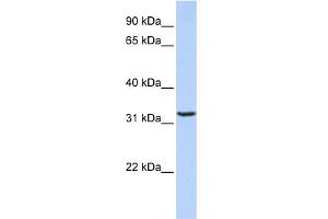 WB Suggested Anti-JMJD8 Antibody Titration: 0. (JMJD8 抗体  (Middle Region))
