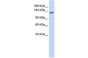WB Suggested Anti-EIF4G2 Antibody Titration:  0. (EIF4G2 抗体  (N-Term))