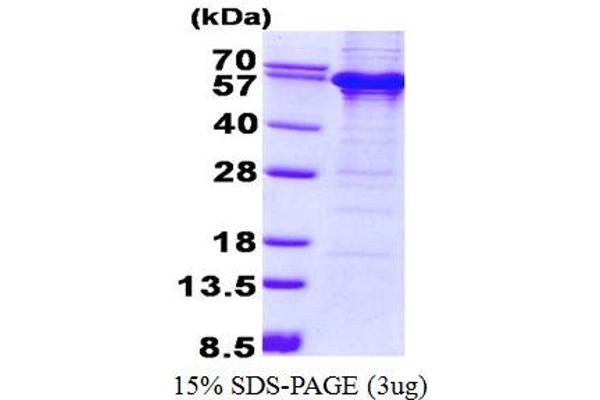 TDG Protein (His tag)