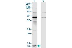 Western Blot analysis of CCL2 expression in transfected 293T cell line by CCL2 monoclonal antibody (M07), clone 2E10. (CCL2 抗体  (AA 1-99))