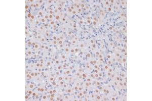 Immunohistochemistry (IHC) image for anti-Histone 3 (H3) (H3K27me) antibody (ABIN3023269)