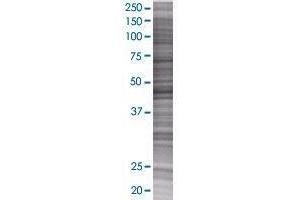 ZBTB37 transfected lysate. (ZBTB37 293T Cell Transient Overexpression Lysate(Denatured))