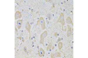 Immunohistochemistry of paraffin-embedded mouse brain using EPHA2 Antibody (ABIN5975494) at dilution of 1/100 (40x lens). (EPH Receptor A2 抗体)