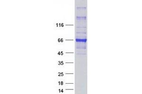 HEPACAM Protein (Myc-DYKDDDDK Tag)