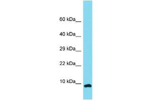 Host: Rabbit Target Name: C12orf75 Sample Type: NCI-H226 Whole Cell lysates Antibody Dilution: 1. (OCC-1 抗体  (N-Term))
