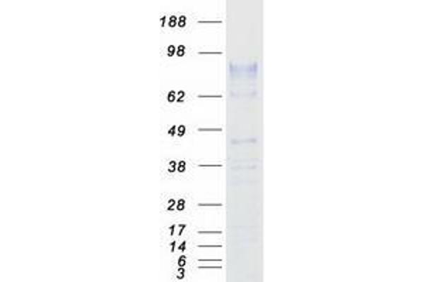 ZP2 Protein (Myc-DYKDDDDK Tag)