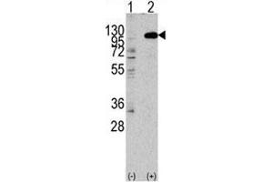 Western blot analysis of FGFR2 antibody and 293 lysate transiently transfected with the human gene. (FGFR2 抗体  (AA 794-821))