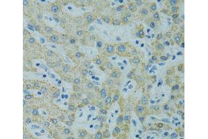 Immunohistochemistry of paraffin-embedded Human liver using STX1A Polyclonal Antibody at dilution of 1:100 (40x lens). (STX1A 抗体)