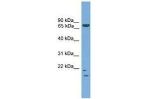 Image no. 1 for anti-MRE11 Meiotic Recombination 11 Homolog A (S. Cerevisiae) (MRE11A) (AA 35-84) antibody (ABIN6745121) (Mre11 抗体  (AA 35-84))