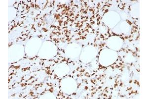 Immunohistochemistry (Formalin-fixed Paraffin-embedded Sections) (IHC (fp)) image for anti-Histone antibody (ABIN3024807)