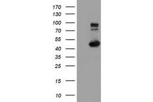 Western Blotting (WB) image for anti-Intraflagellar Transport 57 Homolog (IFT57) antibody (ABIN1498810) (IFT57 抗体)