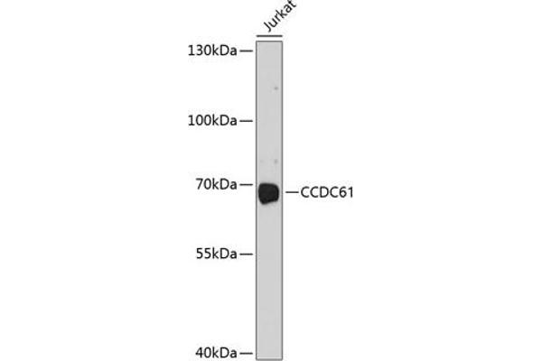 CCDC61 抗体  (AA 352-531)