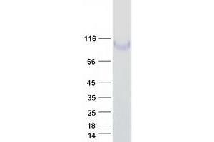 Validation with Western Blot (ITGB1 Protein (Transcript Variant 1A) (Myc-DYKDDDDK Tag))