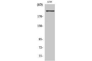Western Blotting (WB) image for anti-T-Type Ca++ CP Alpha1H (Internal Region) antibody (ABIN3180936) (T-Type Ca++ CP Alpha1H (Internal Region) 抗体)