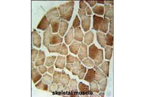 STX7 Antibody immunohistochemistry analysis in formalin fixed and paraffin embedded human skeletal muscle followed by peroxidase conjugation of the secondary antibody and DAB staining. (Syntaxin 7 抗体  (N-Term))