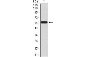 Western blot analysis using HOXA9 mAb against human HOXA9 (AA: 1-272) recombinant protein. (HOXA9 抗体  (AA 1-272))