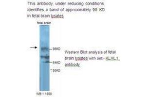 Image no. 1 for anti-Kelch-Like 1 (KLHL1) antibody (ABIN790846) (KLHL1 抗体)