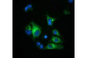 Anti-HP mouse monoclonal antibody (ABIN2453137) immunofluorescent staining of COS7 cells transiently transfected by pCMV6-ENTRY HP (RC223612). (Haptoglobin 抗体)