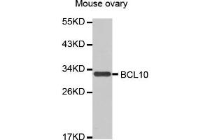 Western Blotting (WB) image for anti-B-Cell CLL/lymphoma 10 (BCL10) antibody (ABIN1678837) (BCL10 抗体)