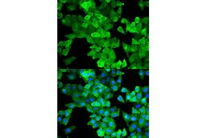 Immunofluorescence (IF) image for anti-Caldesmon 1 (CALD1) antibody (ABIN1876554) (Caldesmon 抗体)