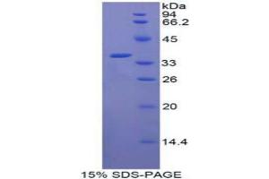 SDS-PAGE analysis of Human CRAF Protein. (CRAF 蛋白)
