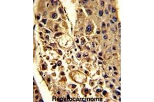 Immunohistochemistry (IHC) image for anti-Complement Factor H-Related 1 (CFHR1) antibody (ABIN3002714) (CFHR1 抗体)