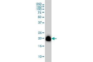 RHOA monoclonal antibody (M08), clone 1C3 Western Blot analysis of RHOA expression in A-431 . (RHOA 抗体  (AA 1-193))