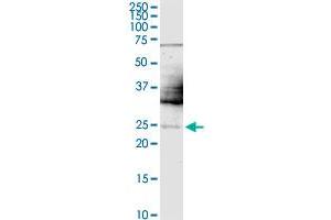 Western Blotting (WB) image for anti-Twist Homolog 1 (Drosophila) (TWIST1) (AA 100-202) antibody (ABIN563296)