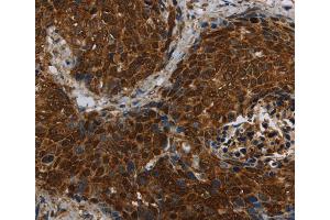 Immunohistochemistry (IHC) image for anti-LAG1 Homolog, Ceramide Synthase 5 (LASS5) antibody (ABIN2434918) (LASS5 抗体)