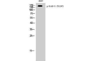 Western Blotting (WB) image for anti-Receptor Tyrosine-Protein Kinase ErbB-3 (ERBB3) (pTyr1197) antibody (ABIN6280961) (ERBB3 抗体  (pTyr1197))