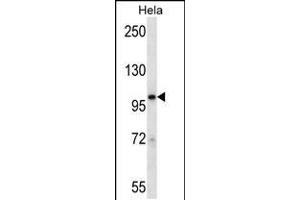 Western blot analysis in Hela cell line lysates (35ug/lane). (STAT2 抗体  (N-Term))