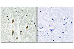 Immunohistochemistry (IHC) image for anti-P21-Activated Kinases 1/2/3 (PAK1/2/3) (Thr402), (Thr421), (Thr423) antibody (ABIN1847964) (PAK1/2/3 抗体  (Thr402, Thr421, Thr423))