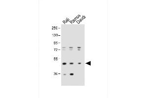 All lanes : Anti-IGHE Antibody (Center) at 1:1000 dilution Lane 1: Raji whole cell lysate Lane 2: Ramos whole cell lysate Lane 3:Daudi whole cell lysate Lysates/proteins at 20 μg per lane. (IgE 抗体  (AA 246-275))