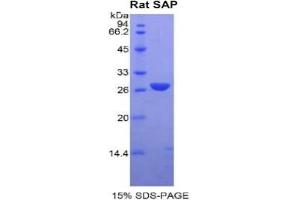 SDS-PAGE analysis of Rat SAP Protein. (APCS 蛋白)