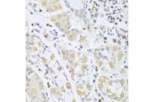 Immunohistochemistry of paraffin-embedded human stomach using SGCB antibody. (SGCB 抗体)