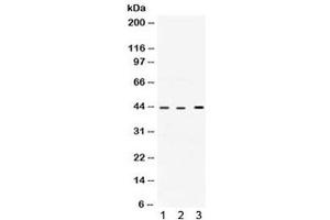 Western blot testing of 1) rat heart, 2) human HepG2 and 3) human A549 lysate with VEGFD antibody. (VEGFD (VEGF4) (AA 89-205) 抗体)