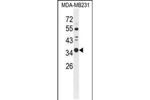 Western blot analysis of STX7 Antibody in MDA-MB231 cell line lysates (35ug/lane) (Syntaxin 7 抗体  (N-Term))