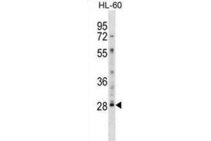 Western Blotting (WB) image for anti-Lymphocyte Antigen 6 Complex, Locus G6F (LY6G6F) antibody (ABIN2999007) (LY6G6F 抗体)