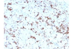 Formalin-fixed, paraffin-embedded human Pituitary stained with Prolactin Mouse Monoclonal Antibody (PRL/2641). (Prolactin 抗体  (AA 63-201))