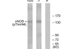 Western blot analysis of extracts from Jurkat cells and HepG2 cells, using eNOS (Phospho-Thr494) antibody. (ENOS 抗体  (pThr494))