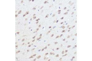 Immunohistochemistry of paraffin-embedded mouse brain using UFM1 Rabbit pAb (ABIN7271184) at dilution of 1:300 (40x lens). (UFM1 抗体  (AA 1-85))