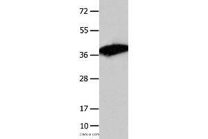 Western blot analysis of Mouse liver tissue , using COPS5 Polyclonal Antibody at dilution of 1:1550 (COPS5 抗体)