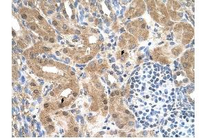 MGC39633 antibody was used for immunohistochemistry at a concentration of 4-8 ug/ml to stain Epithelial cells of renal tubule (arrows) in Human Kidney. (MGC39633 (N-Term) 抗体)